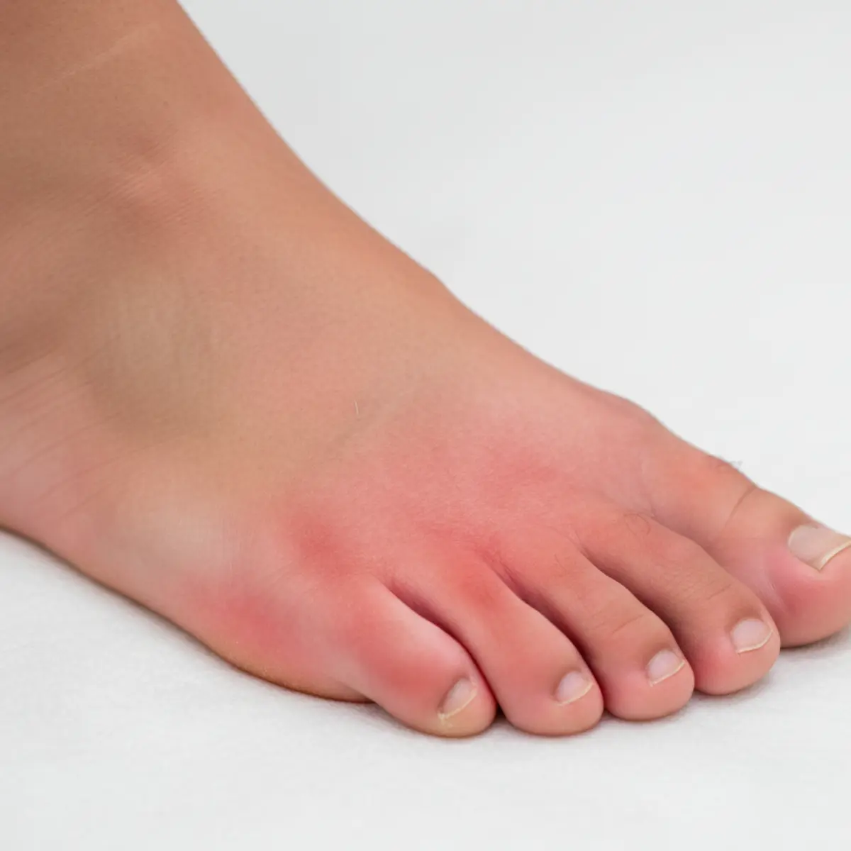 Wizualizacja podrażnionej skóry